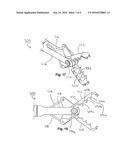 ENDOSCOPIC GRASPING DEVICE diagram and image