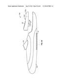 HAND OPERATED REACHING DEVICE FOR REMOVING TICKS FROM ANIMALS OR HUMANS     AND METHOD OF USE diagram and image