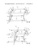 EXTERNAL BONE FIXATION SYSTEM diagram and image