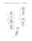 Spinal Implant Assembly diagram and image