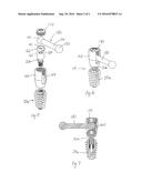 Spinal Implant Assembly diagram and image