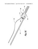 SPINAL IMPLANT WITH A FLEXIBLE EXTENSION ELEMENT diagram and image