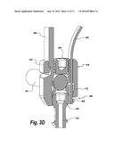 SPINAL IMPLANT WITH A FLEXIBLE EXTENSION ELEMENT diagram and image