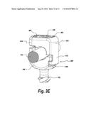 SPINAL IMPLANT WITH A FLEXIBLE EXTENSION ELEMENT diagram and image