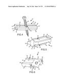 INTEGRATED ELECTROMAGNETIC IMPLANT GUIDANCE SYSTEMS AND METHODS OF USE FOR     SACROILIAC JOINT FUSION diagram and image