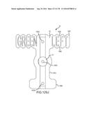 INTEGRATED ELECTROMAGNETIC IMPLANT GUIDANCE SYSTEMS AND METHODS OF USE FOR     SACROILIAC JOINT FUSION diagram and image