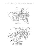 INTEGRATED ELECTROMAGNETIC IMPLANT GUIDANCE SYSTEMS AND METHODS OF USE FOR     SACROILIAC JOINT FUSION diagram and image