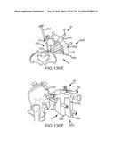 INTEGRATED ELECTROMAGNETIC IMPLANT GUIDANCE SYSTEMS AND METHODS OF USE FOR     SACROILIAC JOINT FUSION diagram and image