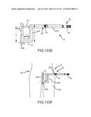 INTEGRATED ELECTROMAGNETIC IMPLANT GUIDANCE SYSTEMS AND METHODS OF USE FOR     SACROILIAC JOINT FUSION diagram and image