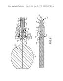 INTEGRATED ELECTROMAGNETIC IMPLANT GUIDANCE SYSTEMS AND METHODS OF USE FOR     SACROILIAC JOINT FUSION diagram and image