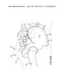 INTEGRATED ELECTROMAGNETIC IMPLANT GUIDANCE SYSTEMS AND METHODS OF USE FOR     SACROILIAC JOINT FUSION diagram and image