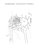 INTEGRATED ELECTROMAGNETIC IMPLANT GUIDANCE SYSTEMS AND METHODS OF USE FOR     SACROILIAC JOINT FUSION diagram and image