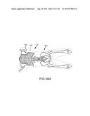 INTEGRATED ELECTROMAGNETIC IMPLANT GUIDANCE SYSTEMS AND METHODS OF USE FOR     SACROILIAC JOINT FUSION diagram and image