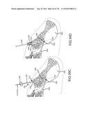 INTEGRATED ELECTROMAGNETIC IMPLANT GUIDANCE SYSTEMS AND METHODS OF USE FOR     SACROILIAC JOINT FUSION diagram and image