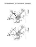 INTEGRATED ELECTROMAGNETIC IMPLANT GUIDANCE SYSTEMS AND METHODS OF USE FOR     SACROILIAC JOINT FUSION diagram and image