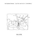 INTEGRATED ELECTROMAGNETIC IMPLANT GUIDANCE SYSTEMS AND METHODS OF USE FOR     SACROILIAC JOINT FUSION diagram and image