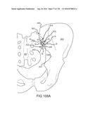 INTEGRATED ELECTROMAGNETIC IMPLANT GUIDANCE SYSTEMS AND METHODS OF USE FOR     SACROILIAC JOINT FUSION diagram and image