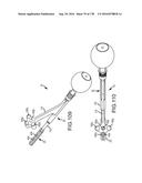 INTEGRATED ELECTROMAGNETIC IMPLANT GUIDANCE SYSTEMS AND METHODS OF USE FOR     SACROILIAC JOINT FUSION diagram and image