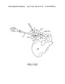 INTEGRATED ELECTROMAGNETIC IMPLANT GUIDANCE SYSTEMS AND METHODS OF USE FOR     SACROILIAC JOINT FUSION diagram and image