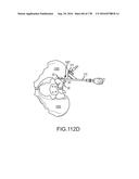 INTEGRATED ELECTROMAGNETIC IMPLANT GUIDANCE SYSTEMS AND METHODS OF USE FOR     SACROILIAC JOINT FUSION diagram and image