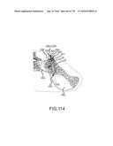 INTEGRATED ELECTROMAGNETIC IMPLANT GUIDANCE SYSTEMS AND METHODS OF USE FOR     SACROILIAC JOINT FUSION diagram and image