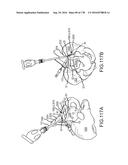 INTEGRATED ELECTROMAGNETIC IMPLANT GUIDANCE SYSTEMS AND METHODS OF USE FOR     SACROILIAC JOINT FUSION diagram and image