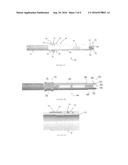 ORTHOPEDIC DEROTATION DEVICES AND METHODS OF INSTALLLATION THEREOF diagram and image