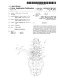 SURGICAL INJECTION SYSTEM AND METHOD diagram and image