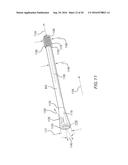 INTRAOSSEOUS INTRAMEDULLARY FIXATION ASSEMBLY AND METHOD OF USE diagram and image