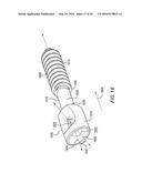 INTRAOSSEOUS INTRAMEDULLARY FIXATION ASSEMBLY AND METHOD OF USE diagram and image