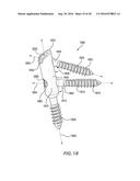 INTRAOSSEOUS INTRAMEDULLARY FIXATION ASSEMBLY AND METHOD OF USE diagram and image