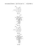 DRUG ELUTING SURGICAL SCREW diagram and image