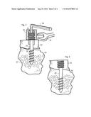 TORQUE DRIVERS FOR HEADLESS THREADED COMPRESSION FASTENERS diagram and image