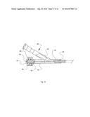 APPARATUS AND METHODS FOR ACCESSING AND DILATING BONE STRUCTURES USING A     NARROW GAUGE CANNULA diagram and image