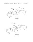 DEVICE FOR EXPANDABLE SPINAL LAMINOPLASTY diagram and image