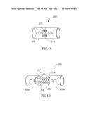 DEVICE FOR EXPANDABLE SPINAL LAMINOPLASTY diagram and image