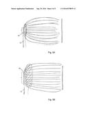 VESSEL ABLATION SYSTEM WITH ADJUSTABLE ABLATION TERMINAL diagram and image