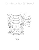 Method for Treating the Thoracic Region of a Patient s Body diagram and image