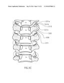 Method for Treating the Thoracic Region of a Patient s Body diagram and image