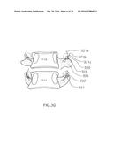 Method for Treating the Thoracic Region of a Patient s Body diagram and image