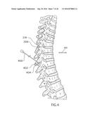 Method for Treating the Thoracic Region of a Patient s Body diagram and image