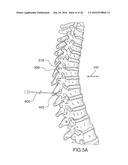 Method for Treating the Thoracic Region of a Patient s Body diagram and image