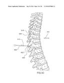 Method for Treating the Thoracic Region of a Patient s Body diagram and image