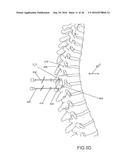 Method for Treating the Thoracic Region of a Patient s Body diagram and image