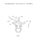 Method for Treating the Thoracic Region of a Patient s Body diagram and image