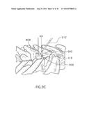 Method for Treating the Thoracic Region of a Patient s Body diagram and image