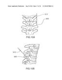 Method for Treating the Thoracic Region of a Patient s Body diagram and image