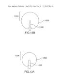 Method for Treating the Thoracic Region of a Patient s Body diagram and image