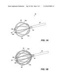 A BASKET CATHETER AND METHOD OF MANUFACTURING diagram and image