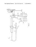 IRRIGATED CATHETER WITH FLUID EVACUATION diagram and image